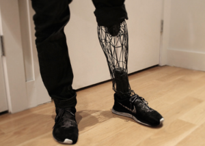 Prothèse de jambe - Exo - William Root - Impression 3D
