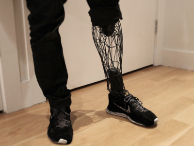 Prothèse de jambe - Exo - William Root - Impression 3D